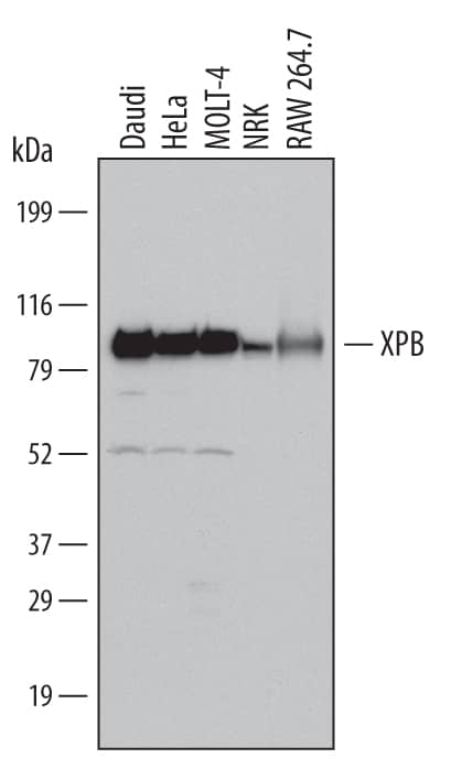 Detection of Human, Mouse, and Rat XPB antibody by Western Blot.