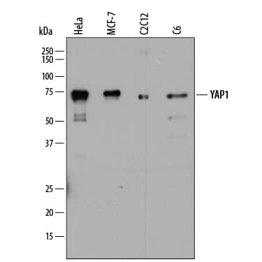 Detection of Human, Mouse, and Rat YAP1 antibody by Western Blot.