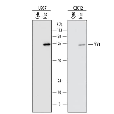 Detection of Human and Mouse YY1 antibody by Western Blot.