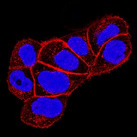 Yes antibody in A431 Human Cell Line by Immunocytochemistry (ICC).