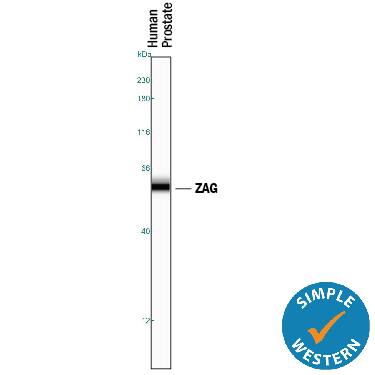 Detection of Human ZAG antibody by Simple WesternTM.