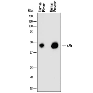 Detection of Human ZAG antibody by Western Blot.