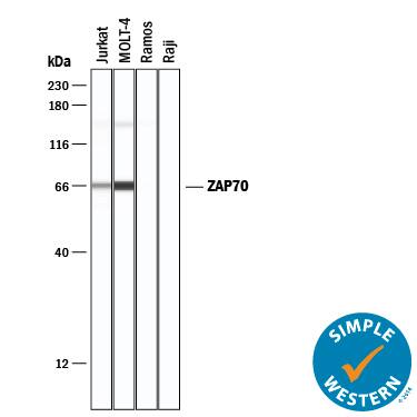 Detection of Human ZAP70 antibody by Simple WesternTM.