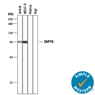 Detection of Human ZAP70 antibody by Simple WesternTM.