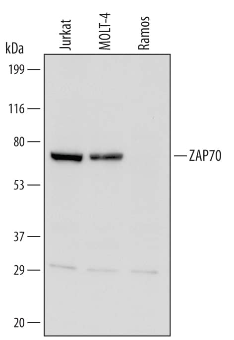 Detection of Human ZAP70 antibody by Western Blot.