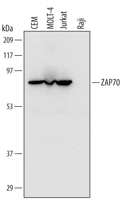 Detection of Human ZAP70 antibody by Western Blot.