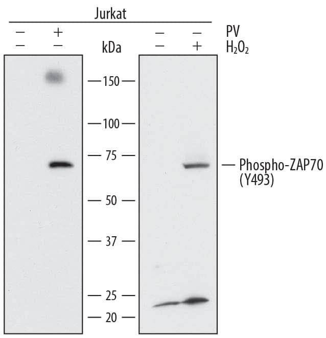 Detection of Human Phospho-ZAP70 (Y493) antibody by Western Blot.