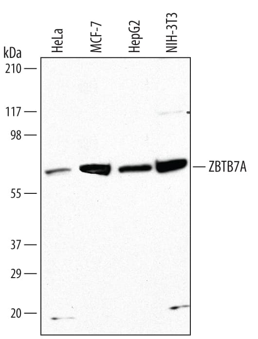 Detection of Human and Mouse ZBTB7A/Pokemon antibody by Western Blot.