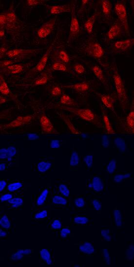 ZEB1 antibody in MDA-MB-231 Human Cell Line by Immunocytochemistry (ICC).