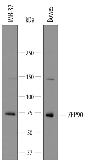 Detection of Human ZFP90 antibody by Western Blot.