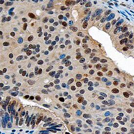ZMIZ1/Zimp10 antibody in Human Ovary by Immunohistochemistry (IHC-P).