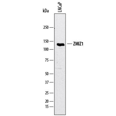 Detection of Human ZMIZ1/Zimp10 antibody by Western Blot.