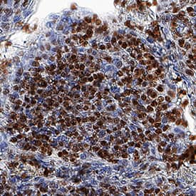 ZNF10 antibody in Human Tonsil by Immunohistochemistry (IHC-P).