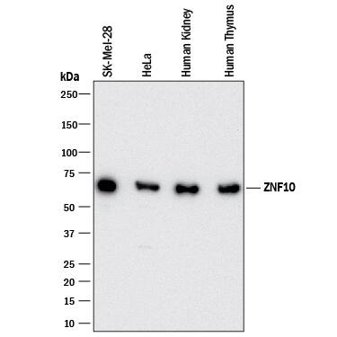 Detection of Human ZNF10 antibody by Western Blot.