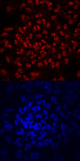 ZNF143 antibody in BG01V Human Stem Cells by Immunocytochemistry (ICC).