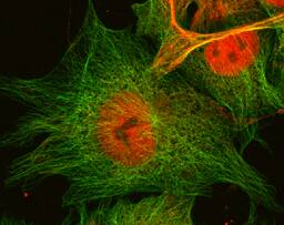 ZNF206 antibody in BG01V Human Embryonic Stem Cells by Immunocytochemistry (ICC).