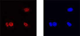 ZNF24 antibody in HepG2 Human Cell Line by Immunocytochemistry (ICC).