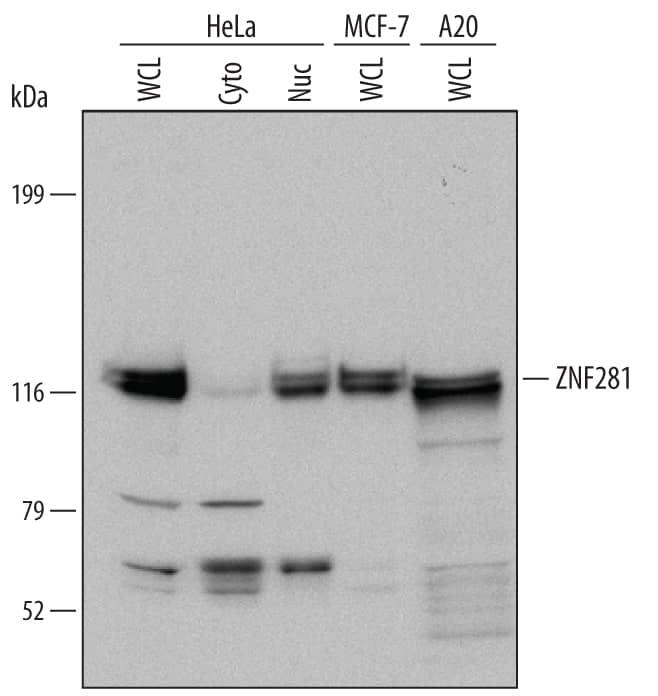 Detection of Human and Mouse ZNF281 antibody by Western Blot.