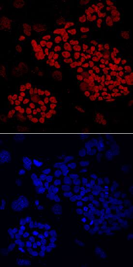 ZNF281 antibody in BG01V Human Embryonic Stem Cells by Immunocytochemistry (ICC).