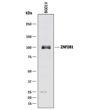 Detection of Human ZNF281 antibody by Western Blot.