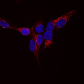 ZNRF3 antibody in HEK Transfectants by Immunocytochemistry (ICC).