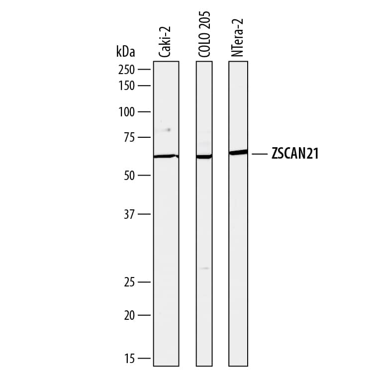 Detection of Human ZSCAN21 antibody by Western Blot.