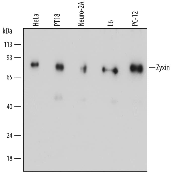 Detection of Human, Mouse, and Rat Zyxin antibody by Western Blot.