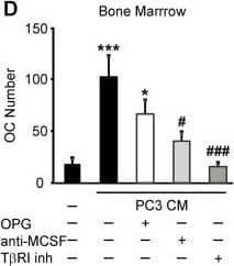 Detection of Human M-CSF by Block/Neutralize