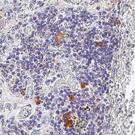 Detection of TNF-alpha  in Human Spleen.