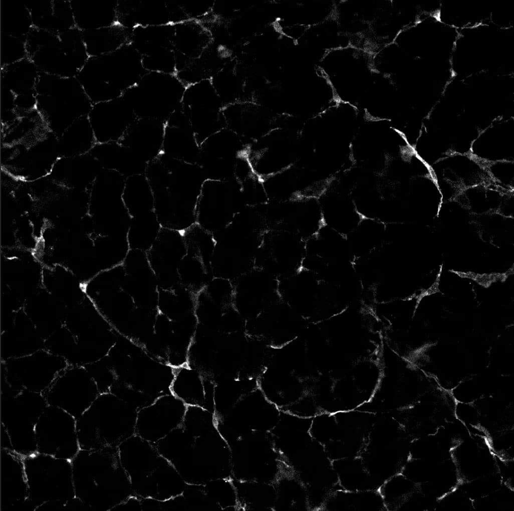 Detection of Mouse PDGF R alpha by Immunohistochemistry.