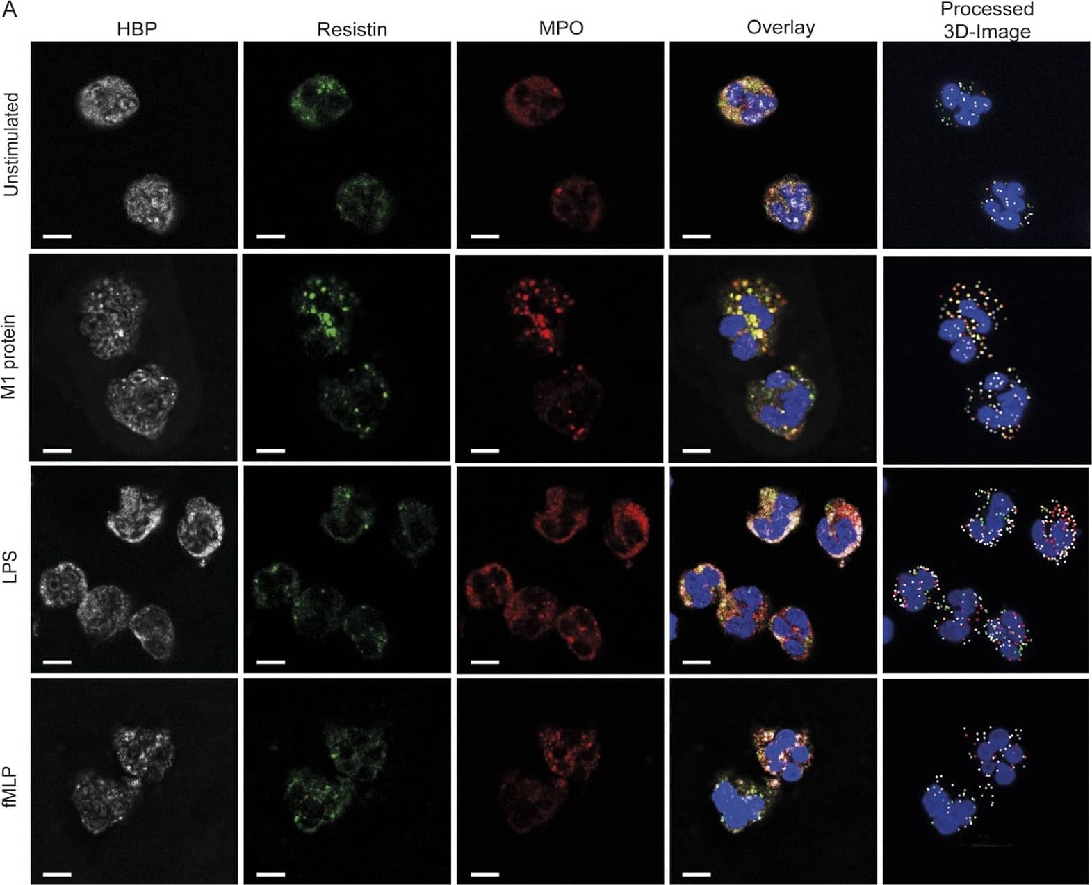 Detection of Human Resistin by Block/Neutralize