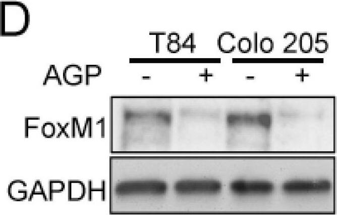 Detection of Human VEGFR2/KDR/Flk-1 by Western Blot