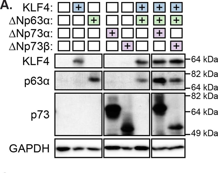 Detection of Human p63/TP73L by Western Blot
