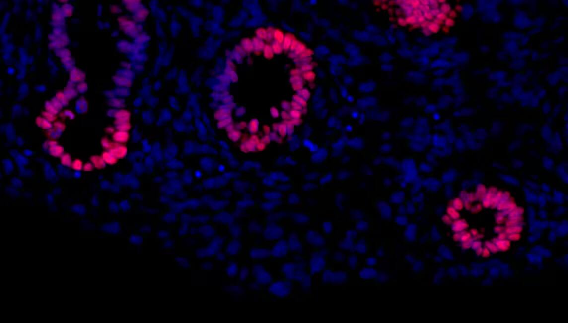 Detection of Human SOX2 by Immunohistochemistry