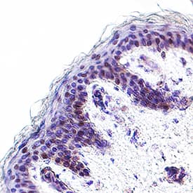 Detection of Pax3 in Human Skin.