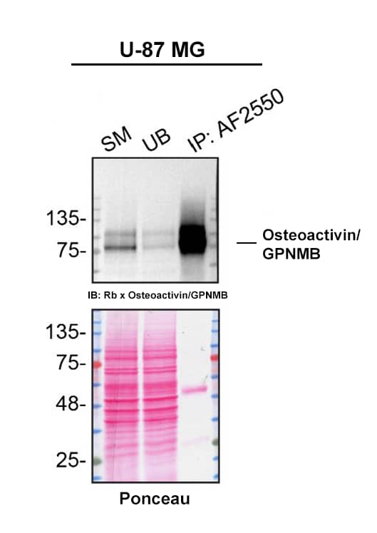 Detection of Osteoactivin/GPNMB by Immunoprecipitation.