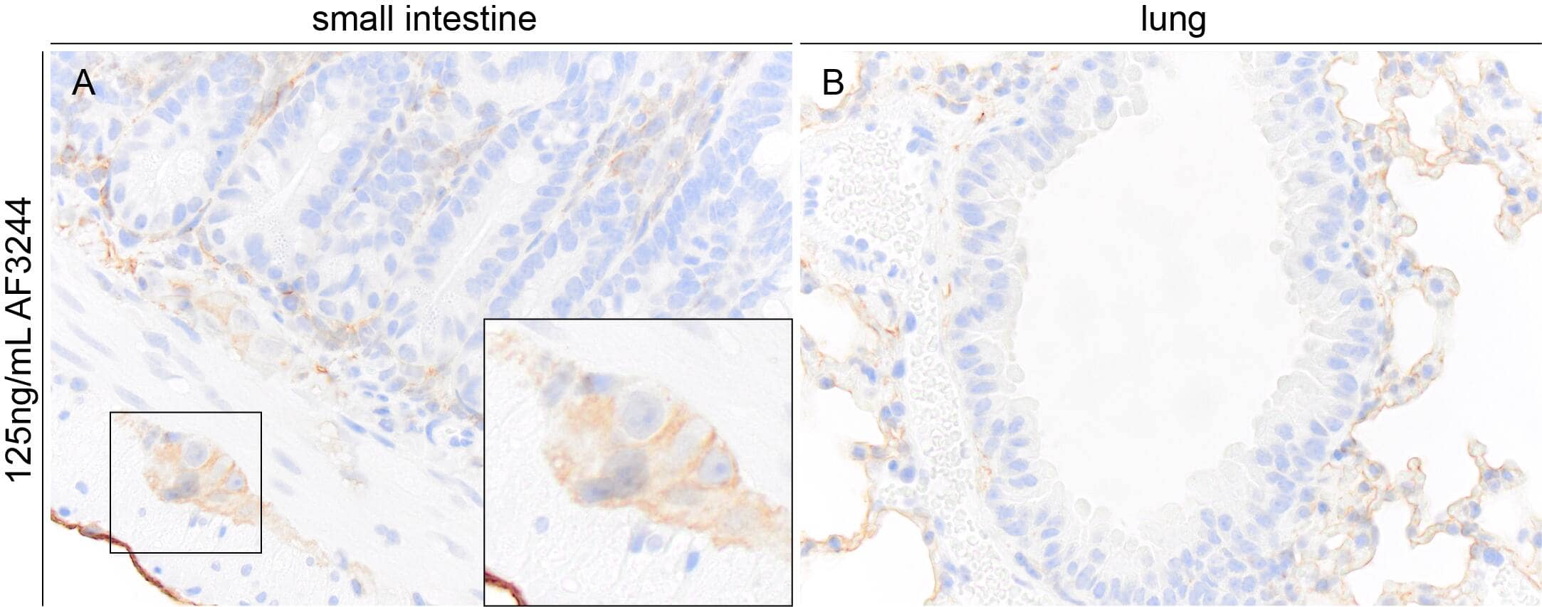 Podoplanin in Mouse Small Intestine and Lung.