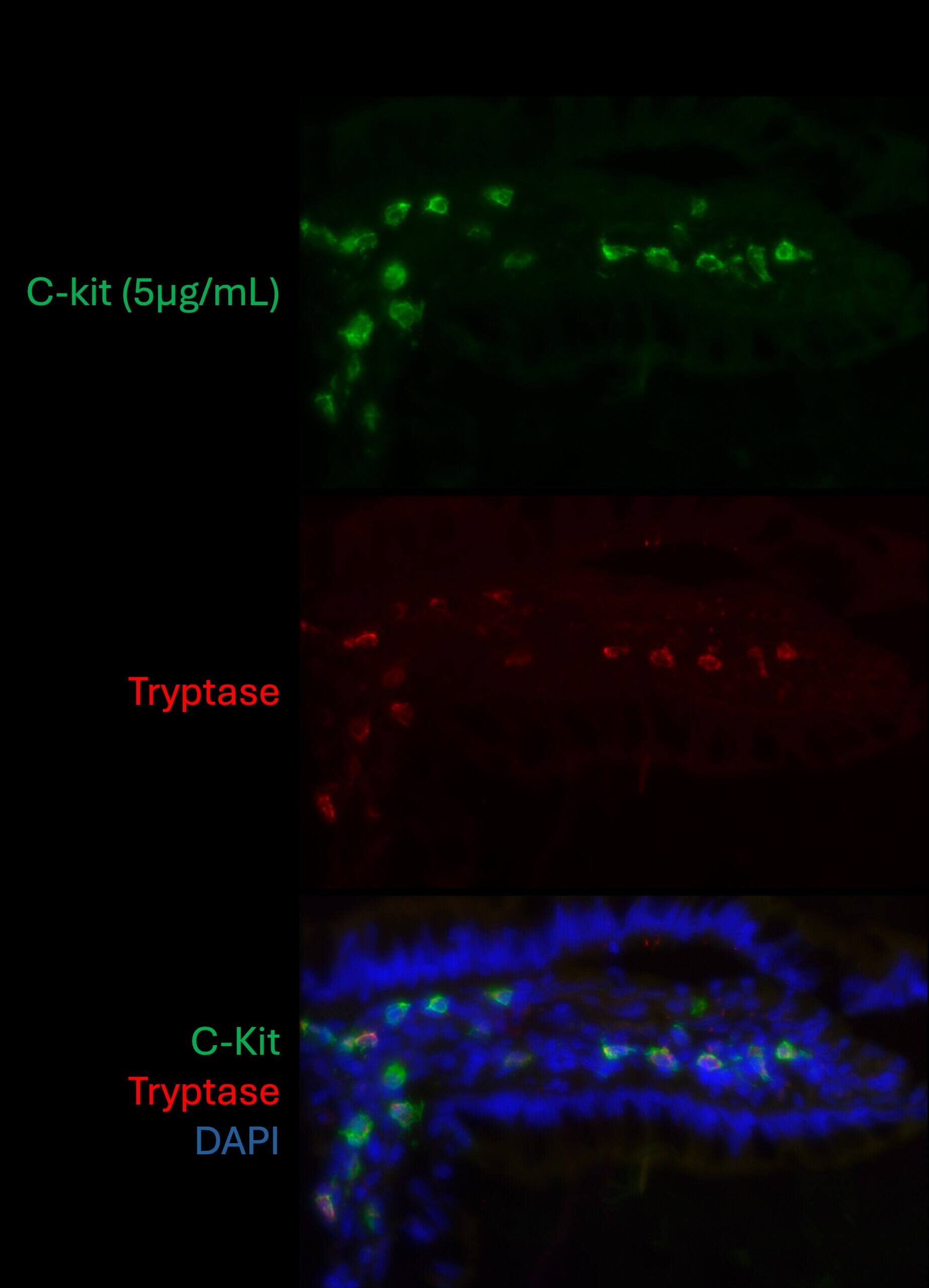 CD117/c-kit in Human Small Intestine.