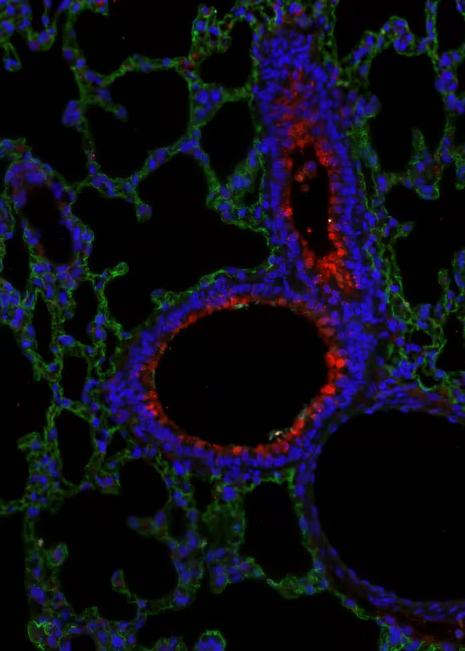 UGRP1/SCGB3A2 in rat lung tissue. UGRP1/SCGB3A2 in rat lung tissue.