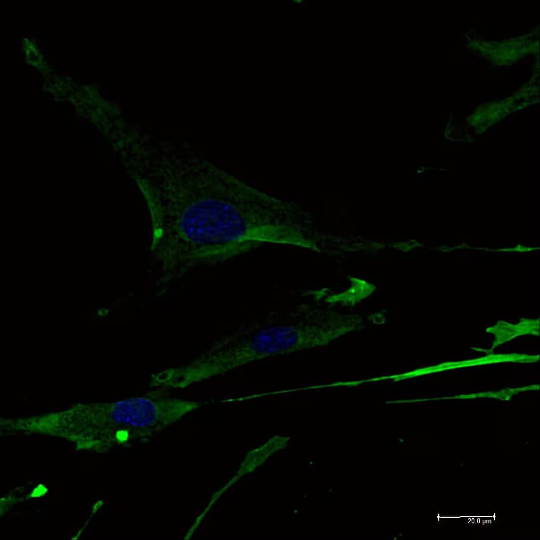 Detection of Mouse CD31/PECAM-1 by Immunocytochemistry/Immunofluorescence.