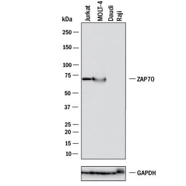 Detection of Human ZAP70 antibody by Western Blot.