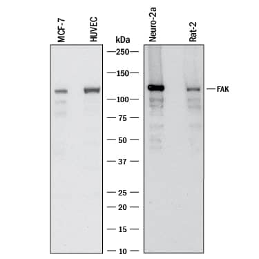 Detection of Human, Mouse, and Rat FAK antibody by Western Blot.