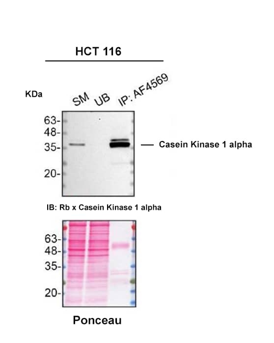 Detection of Casein Kinase 1 alpha by Immunoprecipitation.
