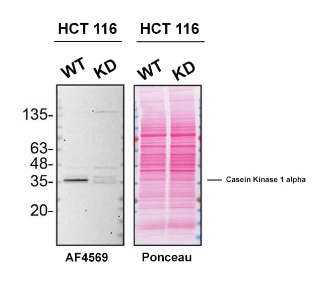 Western Blot Shows Human Casein Kinase 1 alpha Specificity Using Knockdown Cell Line.