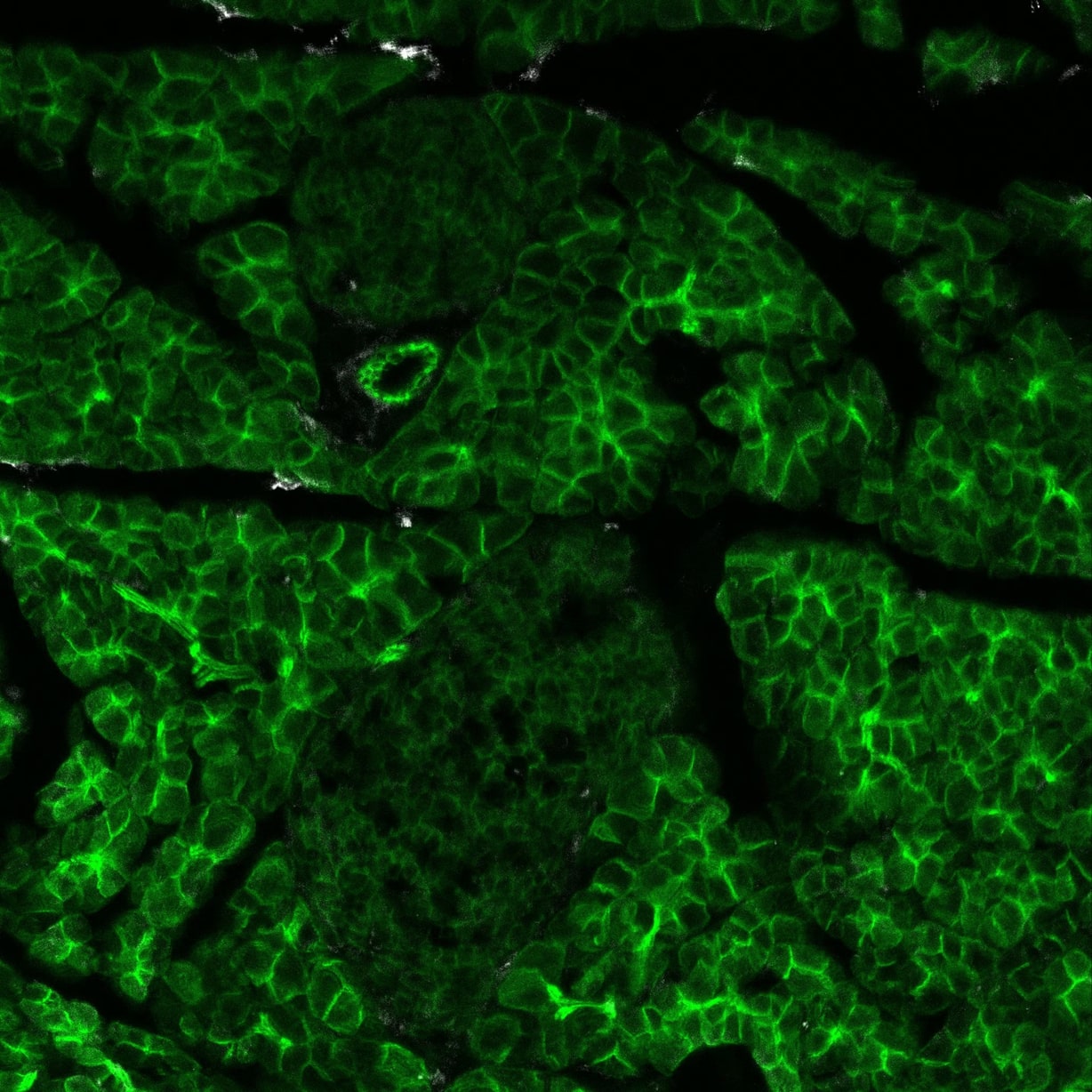 Peptidase Inhibitor 16/PI16 in Mouse Pancreas.