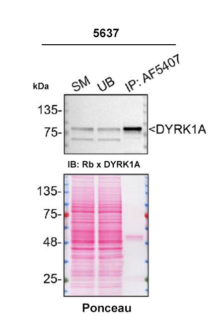 Detection of DYRK1A by Immunoprecipitation.