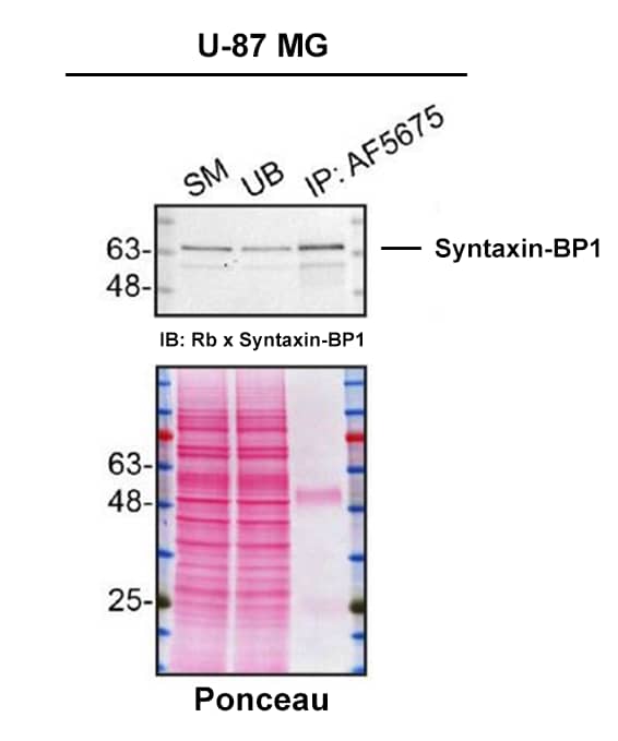 Detection of Syntaxin-BP1 by Immunoprecipitation.