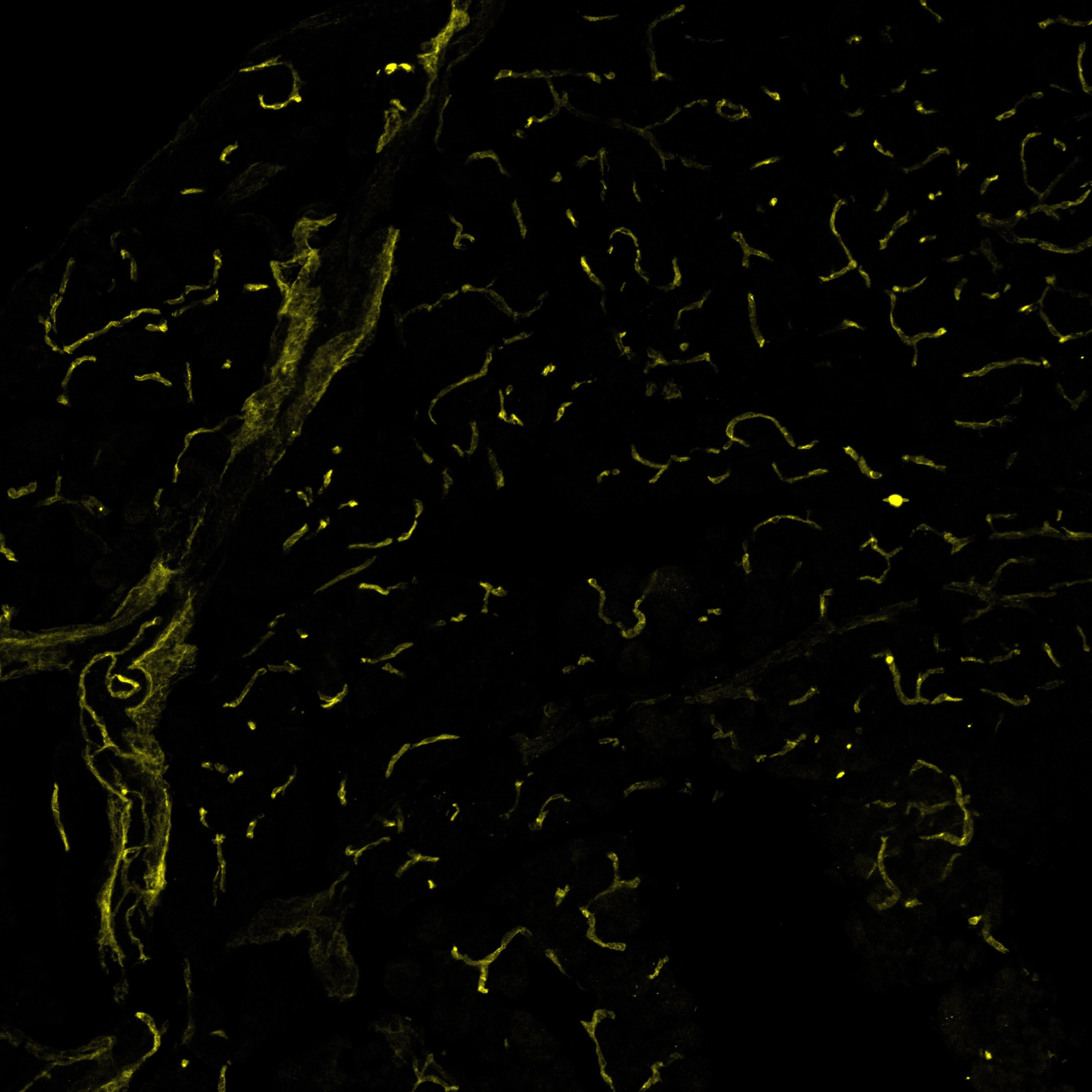 VEGFR2/KDR/Flk‑1 in Mouse Pancreas.