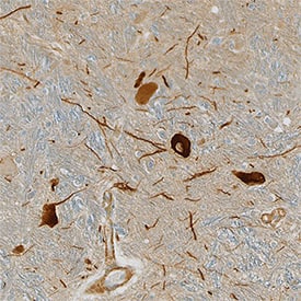 Tyrosine Hydroxylase in Human Brain (Medulla).