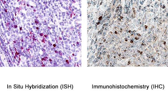 【限定150】ホアンコルネラ 「Humans Are A Virus」 【模写】 Influenza b nucleoprotein antibody HL1069 - The Native